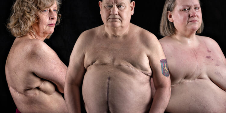 The 11 vague symptoms of an incurable cancer half of Brits have never even heard of - 6 patients' heartbreaking stories