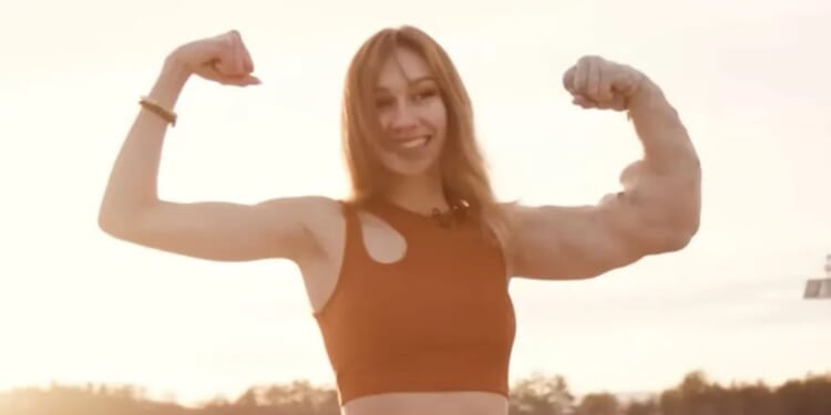 Bullies call me ‘The Hulk’ because of my huge arm, but I was born with it, and I know I’m beautiful