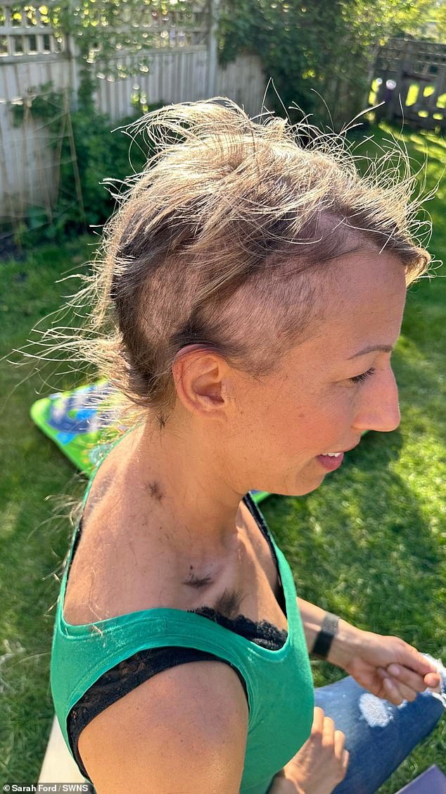 Sarah underwent relentless round of chemotherapy which doctors hoped would help shrink the cancer, which caused her hair to fall out