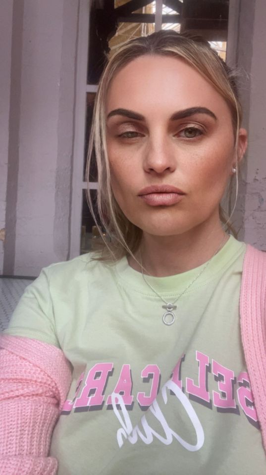 Carla Bellucci's left eye is partially closed, a side effect of Botox.