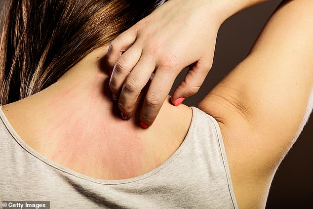 While itchy skin is most often caused by conditions such as eczema or hormonal changes during the menopause, it can also point to illnesses ranging from organ failure to cancer