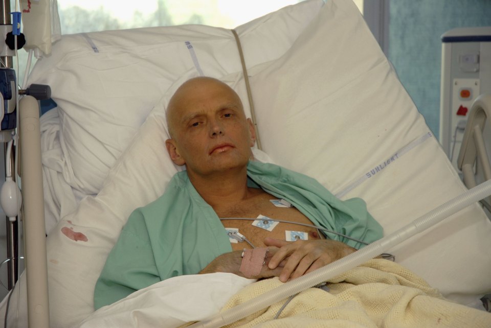 Alexander Litvinenko in hospital, showing signs of radiation poisoning, with a pale face and chest electrodes.