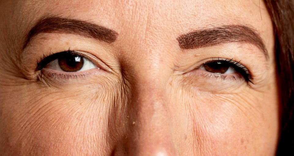 A close-up of a person's eyes, squinting.