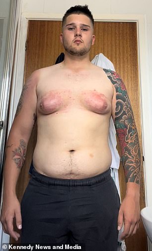 Sam Sawyers avoided taking off his T-shirt and taped his chest down to hide his C-cup moobs