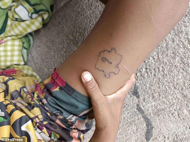 The artist said it would take about three sessions to fully erase all of Kao's tattoos, and promised to do the work free of charge