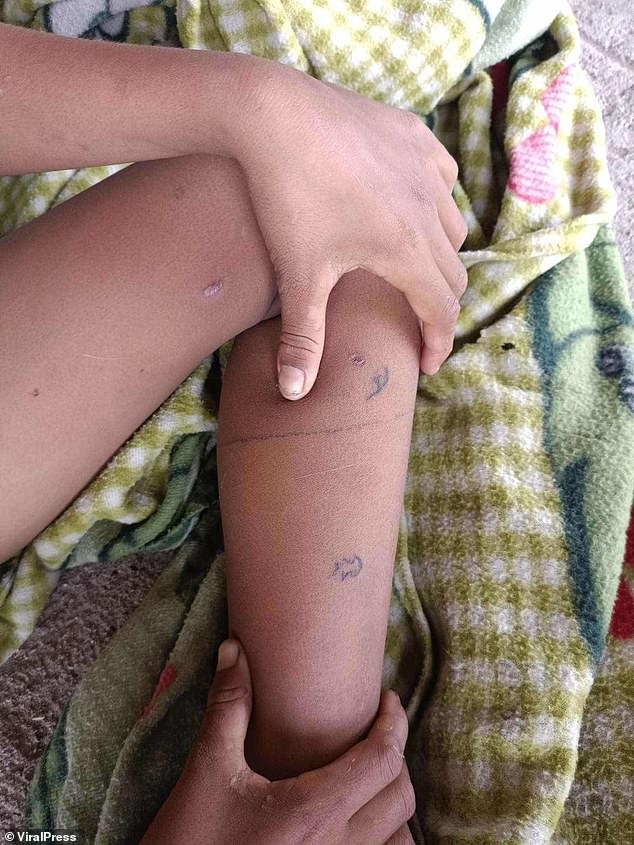 Local tattoo artist Janjira 'Frame' Kaewket immediately offered to help upon seeing the Facebook post