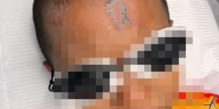 Boy, 10, is left humiliated after having vulgar word written across his FOREHEAD by bullies using a makeshift tattoo gun