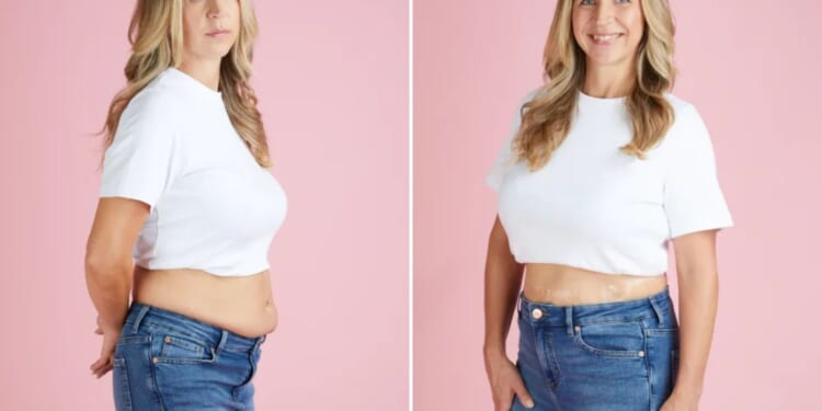 I fixed my ugly muffin top with £3 wonder tape – it’s brilliant for Ozempic tum too