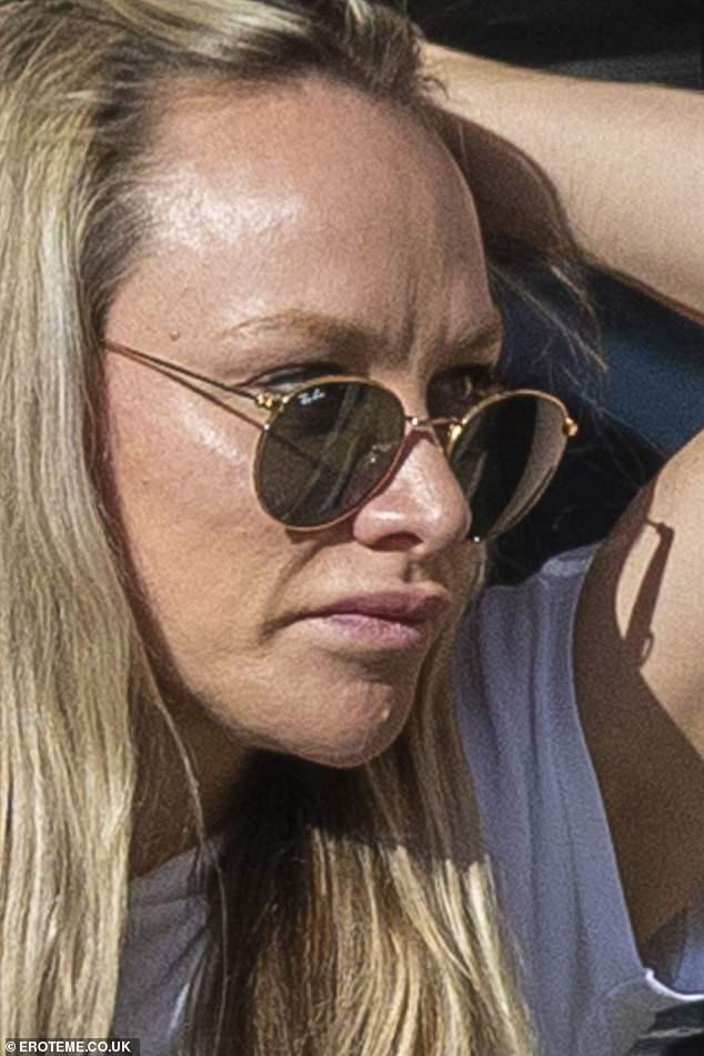 Chloe admitted to having lip fillers before - after a friend did them for free, but said she would never have them again because they looked 'awful'