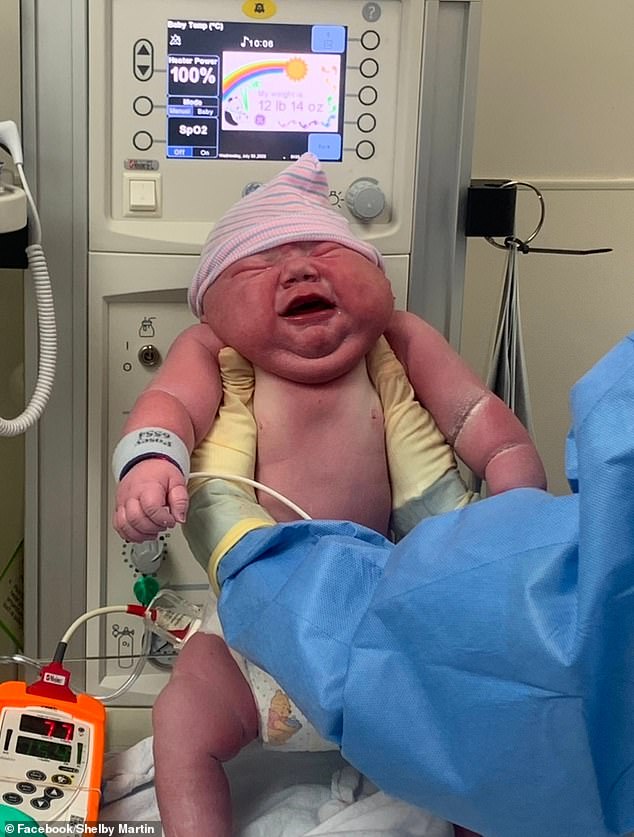 Cassian was delivered via C-section due to his large size