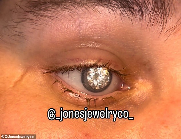Slater Jones, 23, lost vision in his right eye after contracting a toxoplasmosis infection at the age of 17. When it became clear that the eye needed to be removed, Mr Jones decided to design a prosthetic that suited his career as diamond setter