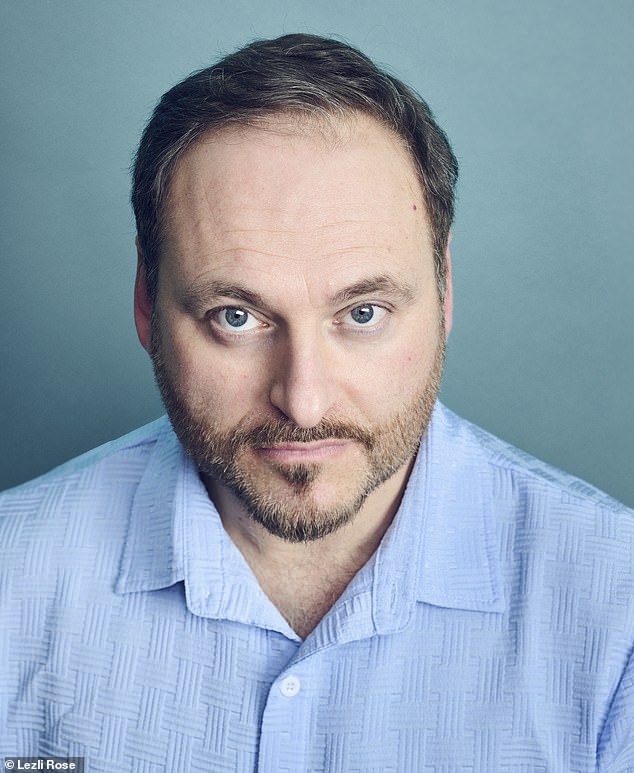 Cornel before his hair transplant