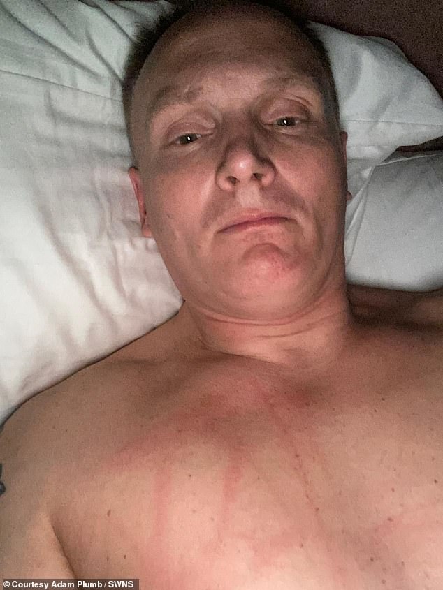 Pictures also show a range of bite marks, bruises and scratches from other incidents of 'abuse' mentioned in court