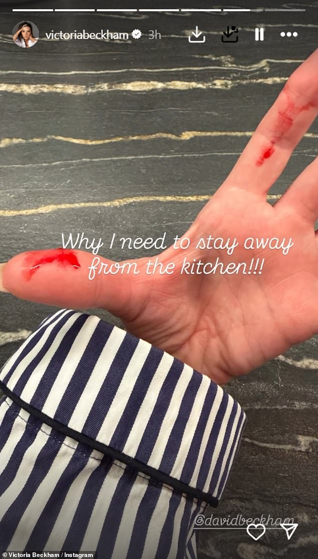 Victoria also took to social media to show her fans how she suffered a nasty kitchen injury as she attempted to cook