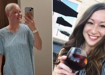 Docs thought my back pain was a running injury and sent me to physio