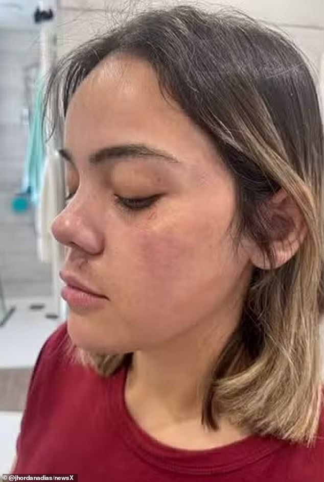 Shocking photos (pictured) show Ms Dias with cuts and bruises to her face
