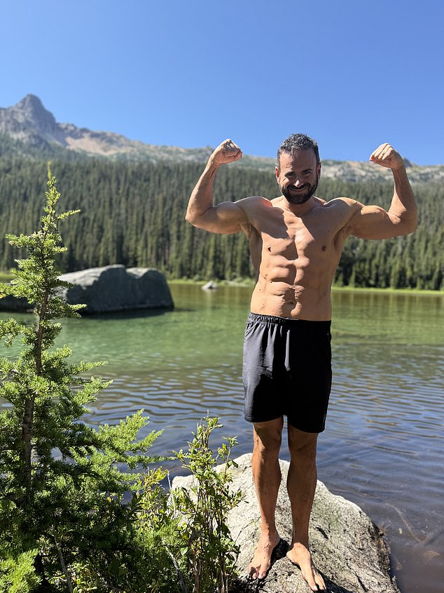 To complete his transformation, Mike underwent a hair transplant