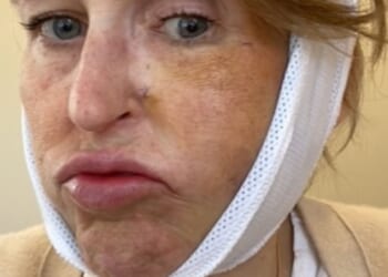 When I kissed my husband goodbye one morning I felt a sharp, electrical current shoot down my face