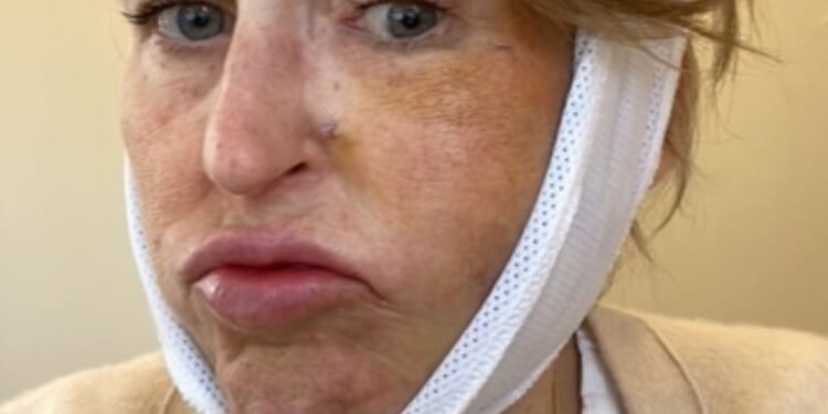 When I kissed my husband goodbye one morning I felt a sharp, electrical current shoot down my face