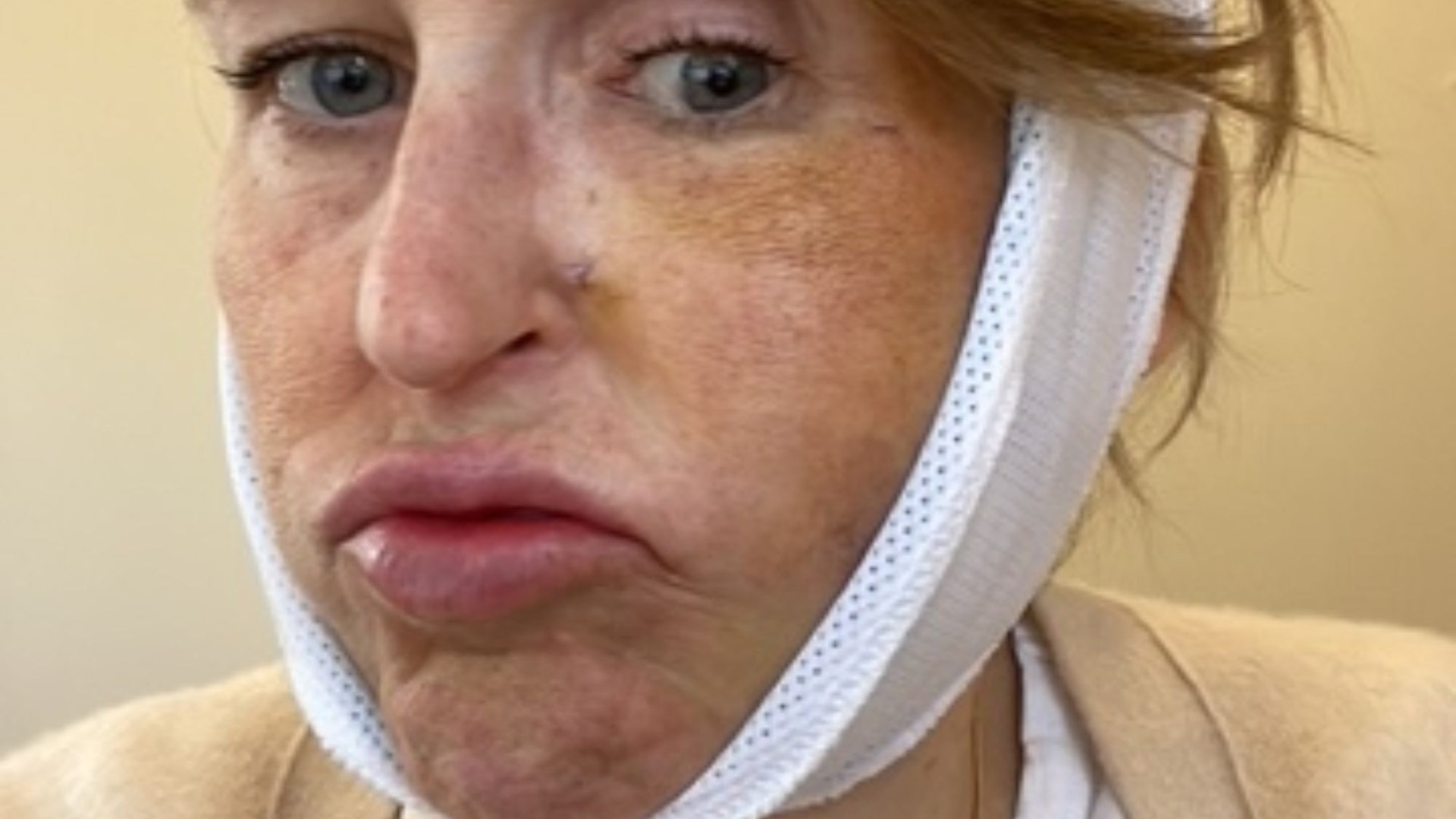 When I kissed my husband goodbye one morning I felt a sharp, electrical current shoot down my face