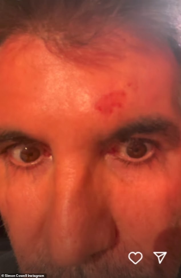 The TV personality, 36, stepped in at the last minute to replace Simon Cowell , 66, after he suffered  a nasty fall ahead of auditions in Birmingham