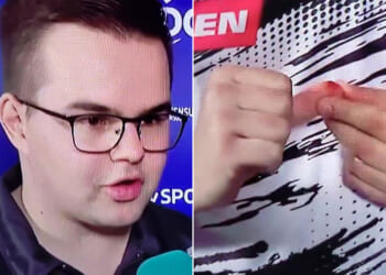Darts star Gian van Veen shows off gruesome cut live on TV before stunning Luke Humphries to win European Championship