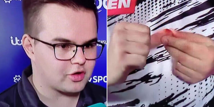 Darts star Gian van Veen shows off gruesome cut live on TV before stunning Luke Humphries to win European Championship