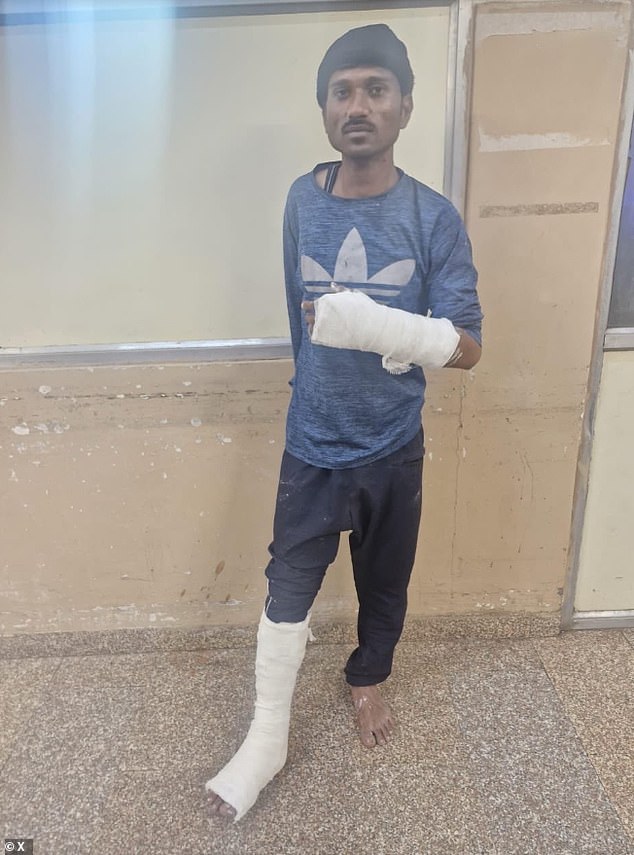 The man charged with molesting Australian women cricket players, is pictured in an Indian police station with his injuries