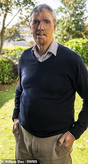 He has now been fitted with an NHS facial prosthetic, the first of its kind