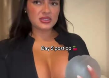 Love Island's Andrada shows off the results of her boob job five days after surgery