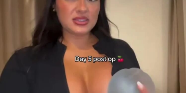 Love Island's Andrada shows off the results of her boob job five days after surgery