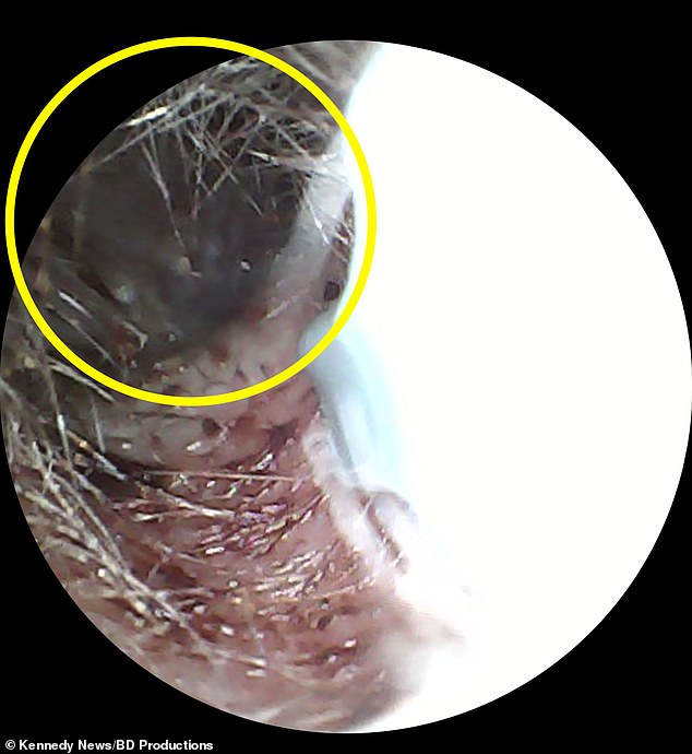 The circled portion of the above image shows where in Doyle's ear the bug had nestled