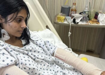 I was scorched to the bone trying a TikTok recipe for Halloween dinner party