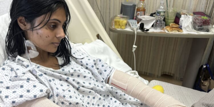 I was scorched to the bone trying a TikTok recipe for Halloween dinner party