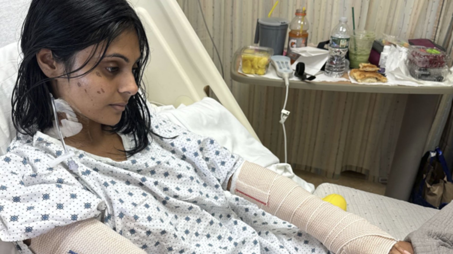 I was scorched to the bone trying a TikTok recipe for Halloween dinner party