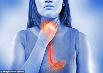 More than 20 percent of Britons will suffer GERD at some point in their lives – and 1.5 million need long-term medication for it