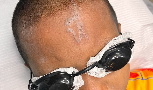 The 10-year-old named Kao, from Kanchanaburi province, was reportedly bullied by his peers who used a makeshift tattoo gun to ink the vulgar word 'p****' onto his skin