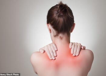 DISH, which stands for diffuse idiopathic skeletal hyperostosis, a type of arthritis that causes bonae to grow, forming spurs, around the body and leads to ligaments becoming calcified