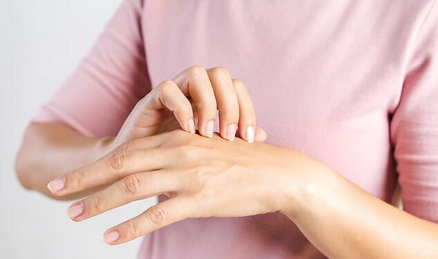 Hand eczema, which leaves skin on the hands and wrists weeping, cracked and sore is most common in those who work with irritating chemicals