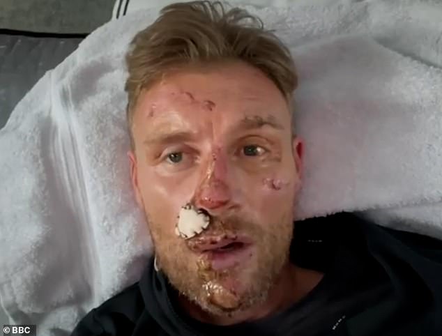 Flintoff revealed the mental toll of the injuries sustained when filming BBC motoring show Top Gear meant he did not leave the house for between six to eight months (pictured 2022)