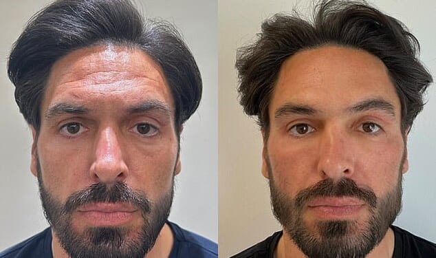 Mario Falcone is determined to keep his title as the hottest dad at the school gates (pictured L before his treatments and R four weeks after his treatments in July)