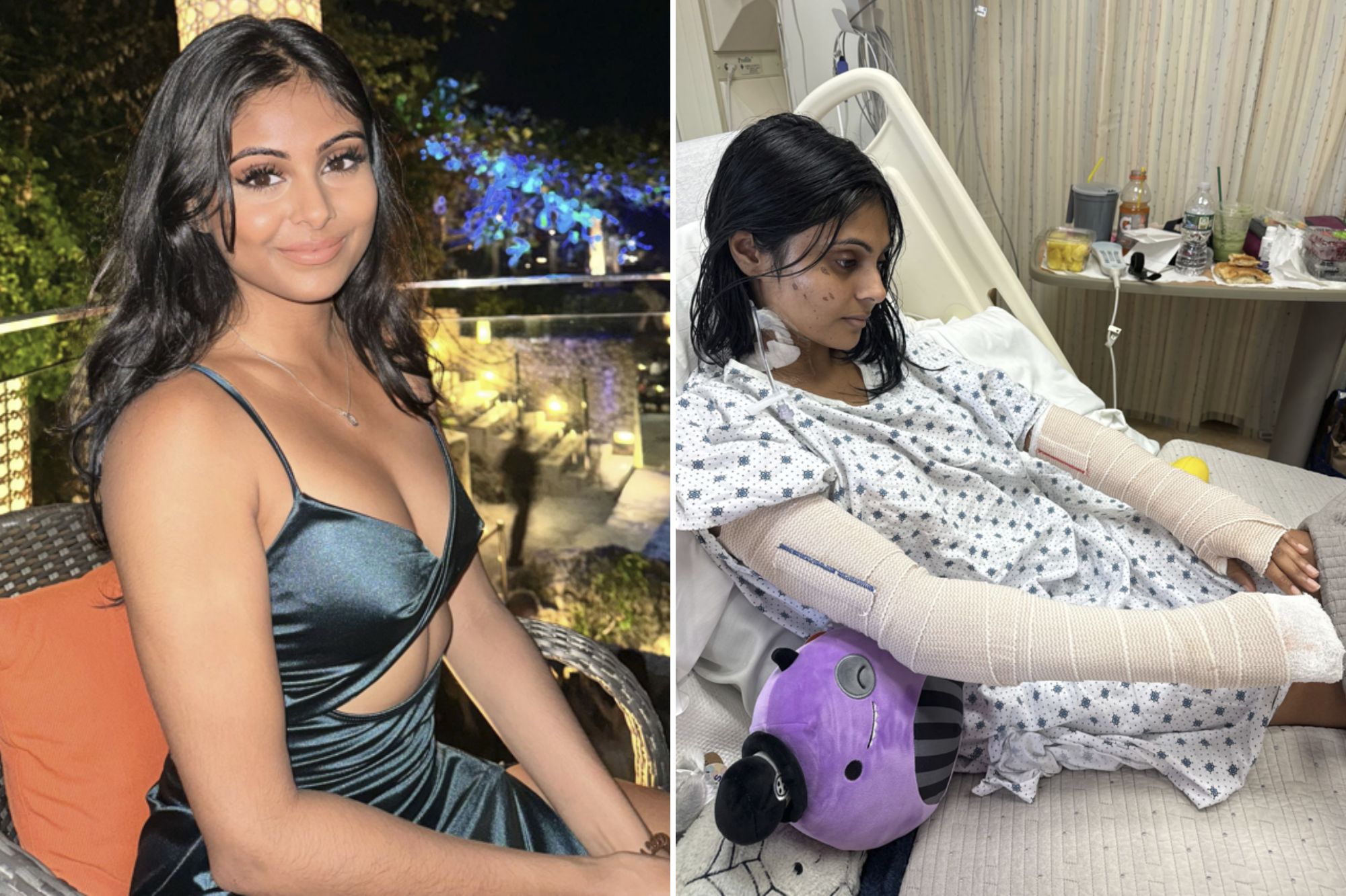 An image collage containing 2 images, Image 1 shows Angelie Ramdial, 30, from New York, wearing a dark green dress and sitting in a wicker chair at night, Image 2 shows Angelie in a hospital bed with both arms bandaged