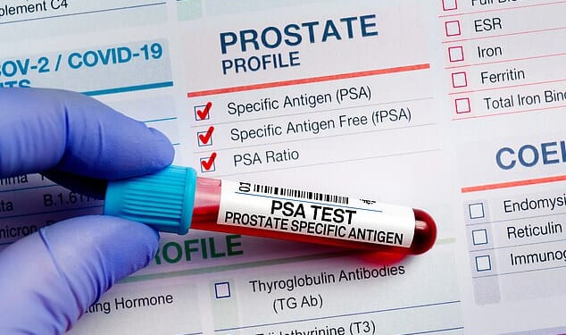 Blood sample tube for prostate cancer PSA test
