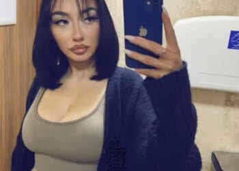 Chloe Richmond, 25, lost her mother and father at a young age - and began suffering headaches soon after