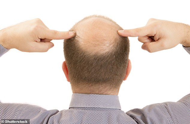 At least half of men over the age of 50 will lose some of their hair just through the ageing process (stock image)