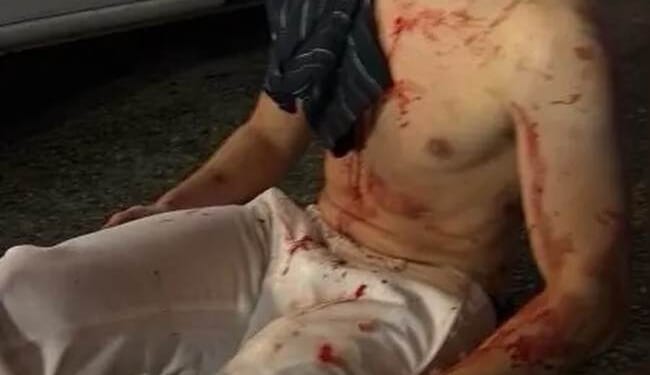 Teens Who Attacked Edward 'Big Balls' Coristine Get Rehabilitated – HotAir