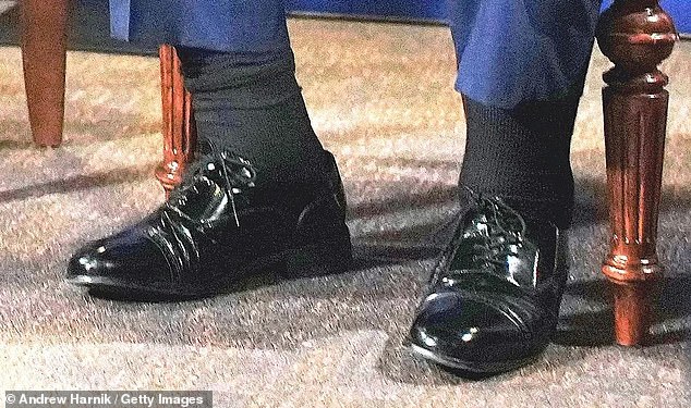 Image of Donald Trump's swollen ankles