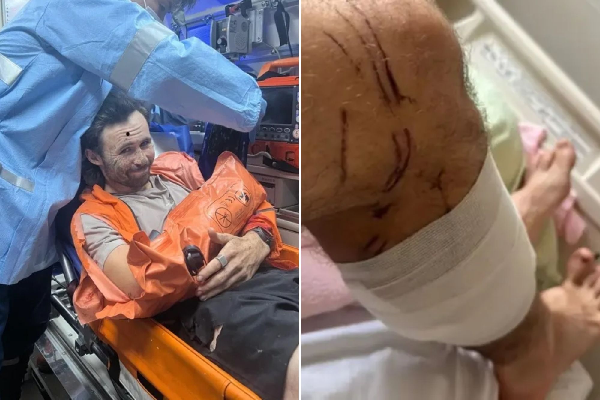 An image collage containing 2 images, Image 1 shows NINTCHDBPICT001032557459, Image 2 shows NINTCHDBPICT001032556876