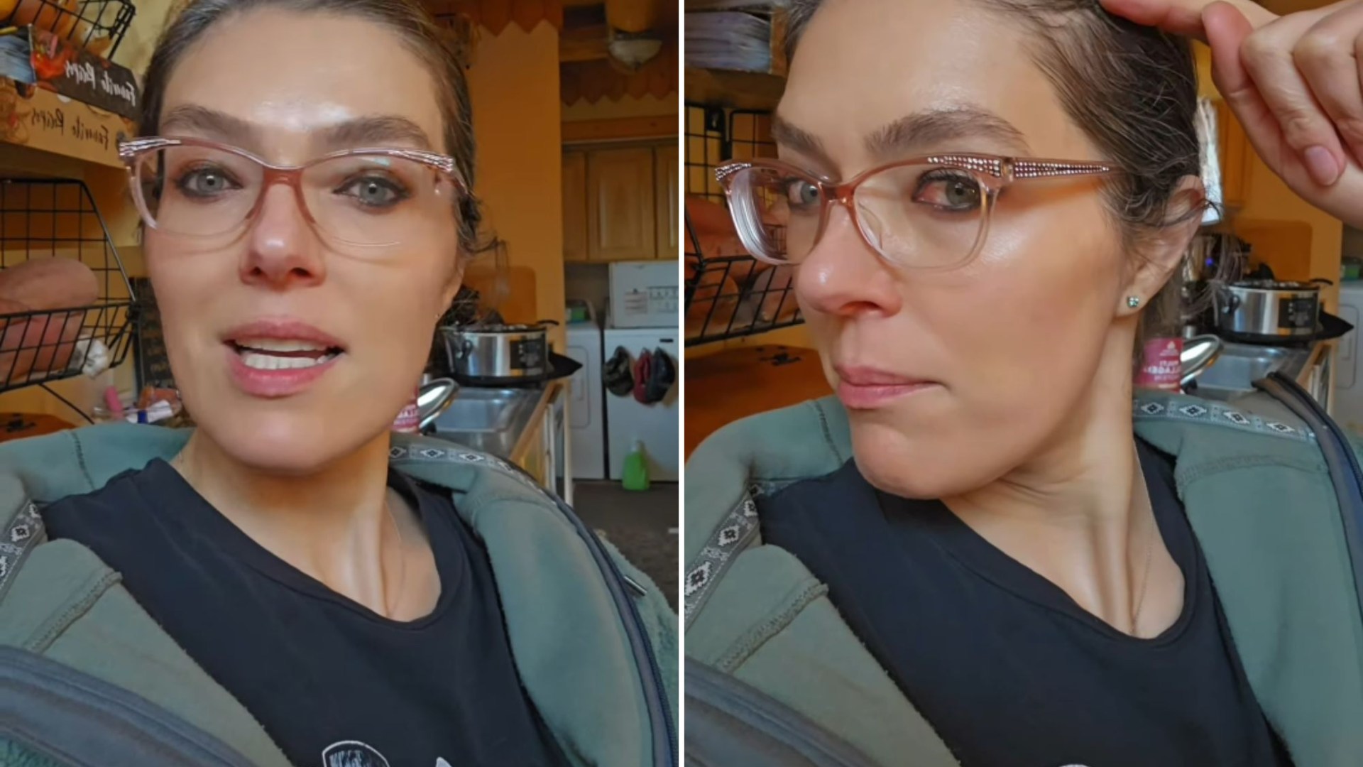 Star of 00s reality series reveals show makeover has left her ‘partially bald’ 22 years later after ‘oozing head wound’