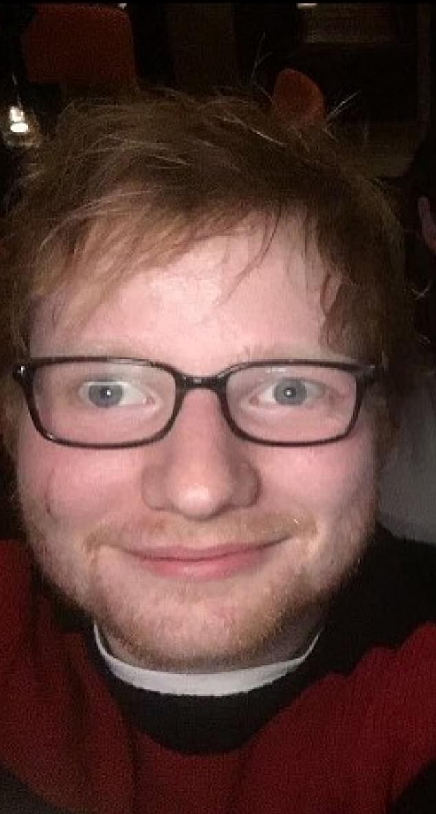 Ed Sheeran with a scratch on his face caused accidentally by Princess Beatrice while she was "knighting" James Blunt with a sword during a party